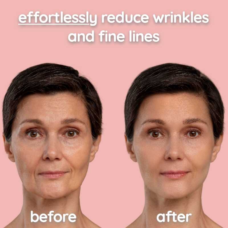 Aurelift™ | ems face mask